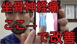 坐骨神経痛　関内